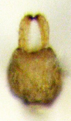 Acizzia acaciaebaileyanae