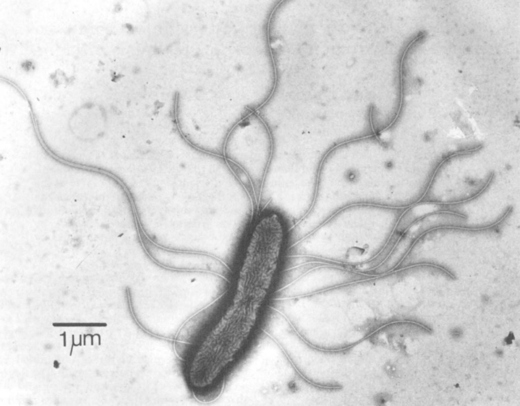 Achromobacter
