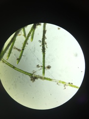 Philodina megalotrocha