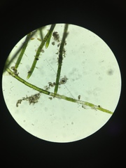 Philodina megalotrocha