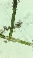 Philodina megalotrocha