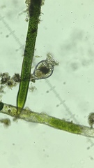 Philodina megalotrocha