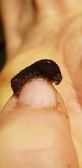 Chytonix