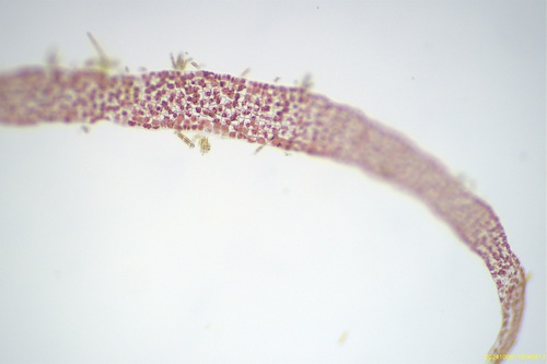 Representative image of Porphyrostromium