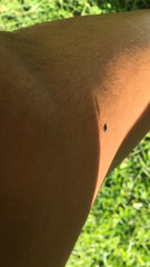 Diptera