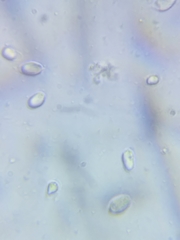 Pseudoomphalina compressipes