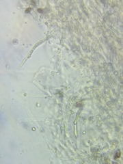 Pseudoomphalina compressipes