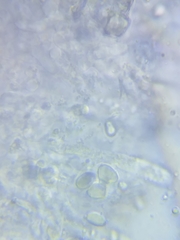 Pseudoomphalina compressipes