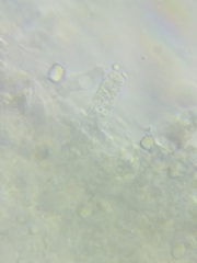 Pseudoomphalina compressipes