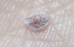 Balanococcus cordylinidis