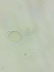 Oudemansiella limonispora