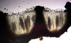 Ocellularia jacinda-arderniae