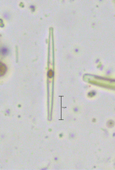 Fragilaria