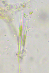Fragilaria
