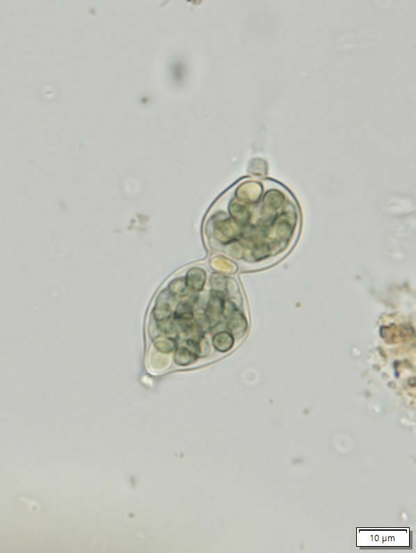 Nostoc paludosum