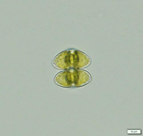 Staurastrum bieneanum