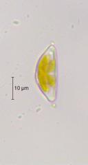 Encyonema