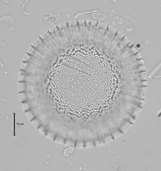 Stephanodiscus reimeri