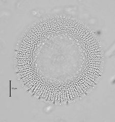 Stephanodiscus reimeri