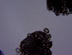 Dolichospermum lemmermannii