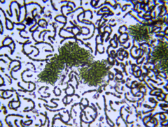 Dolichospermum lemmermannii