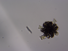 Dolichospermum lemmermannii