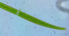 Closterium intermedium