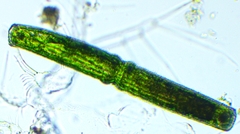 Pleurotaenium coronatum