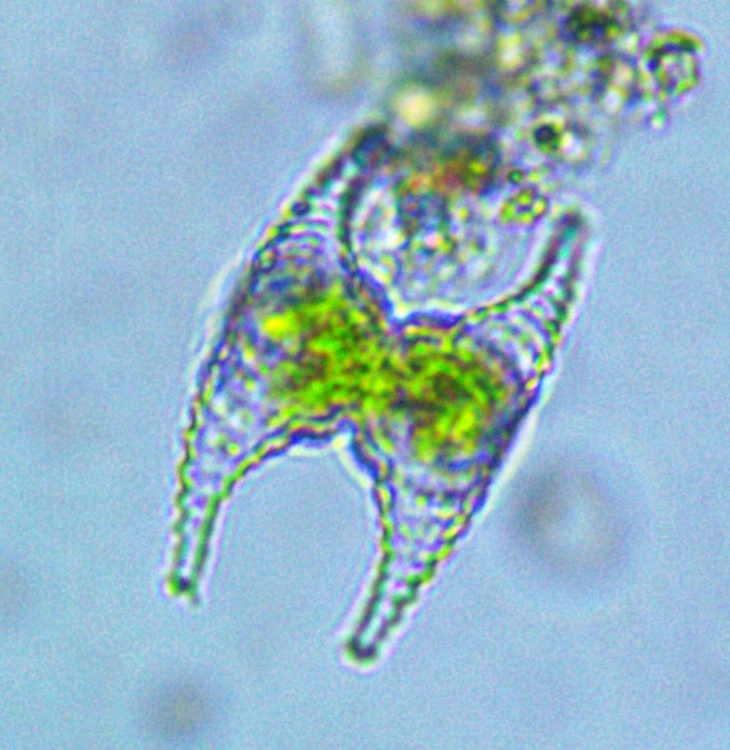 Staurastrum gracile