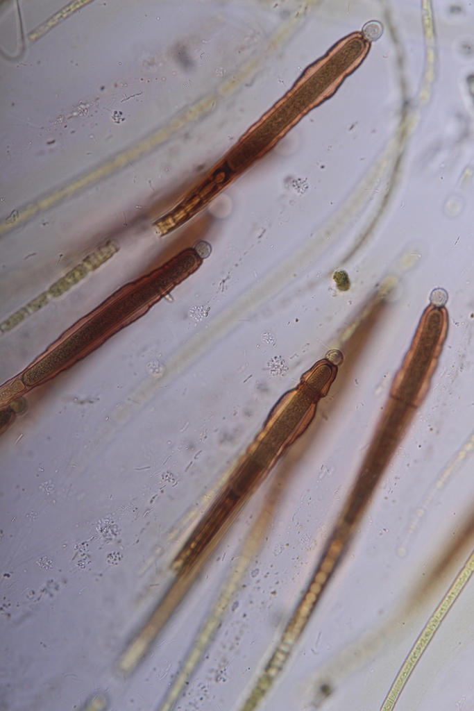 Gloeotrichia intermedia