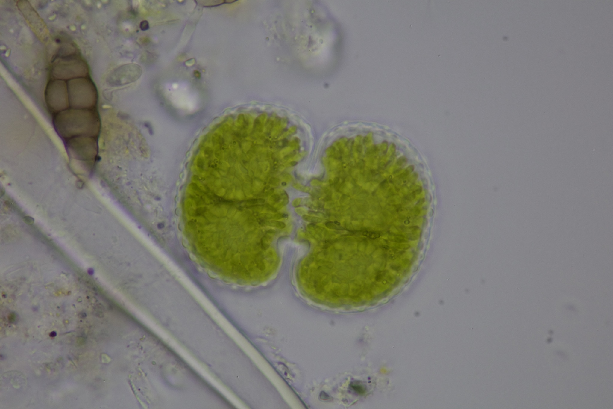 Cosmarium margaritatum