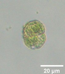 Desmidiaceae