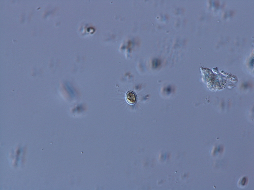 Golenkinia paucispina