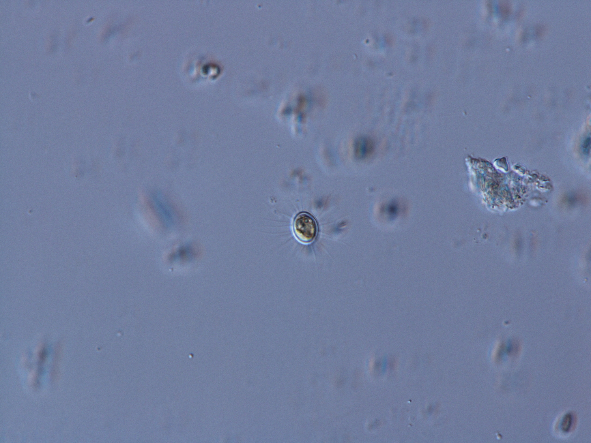 Golenkinia paucispina