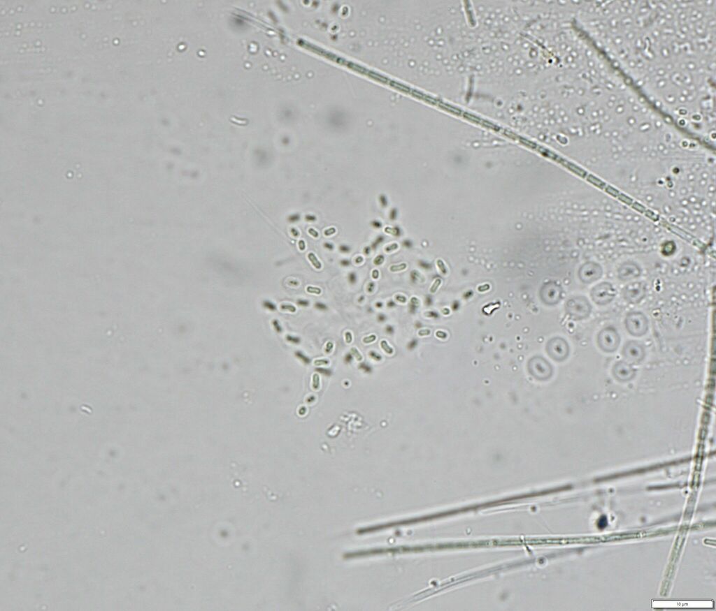 Cyanodictyon