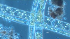 Spirogyra