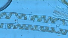 Spirogyra