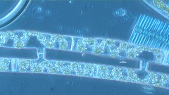 Spirogyra