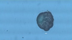 Woronichinia