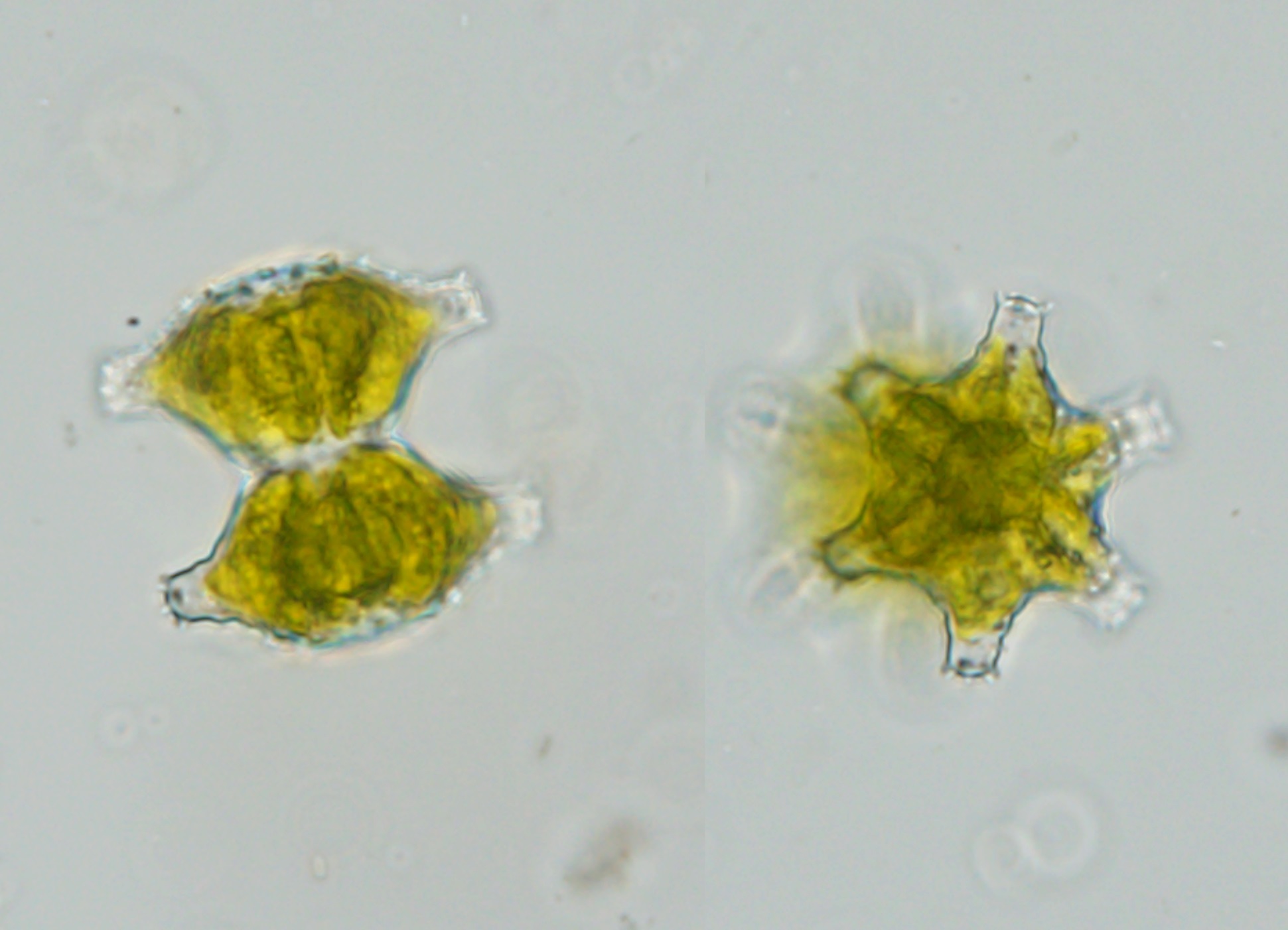 Staurastrum sexcostatum