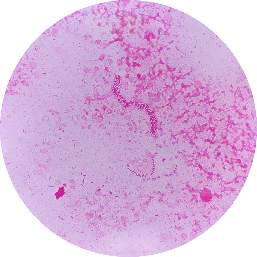 Pantoea
