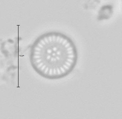 Discostella stelligera