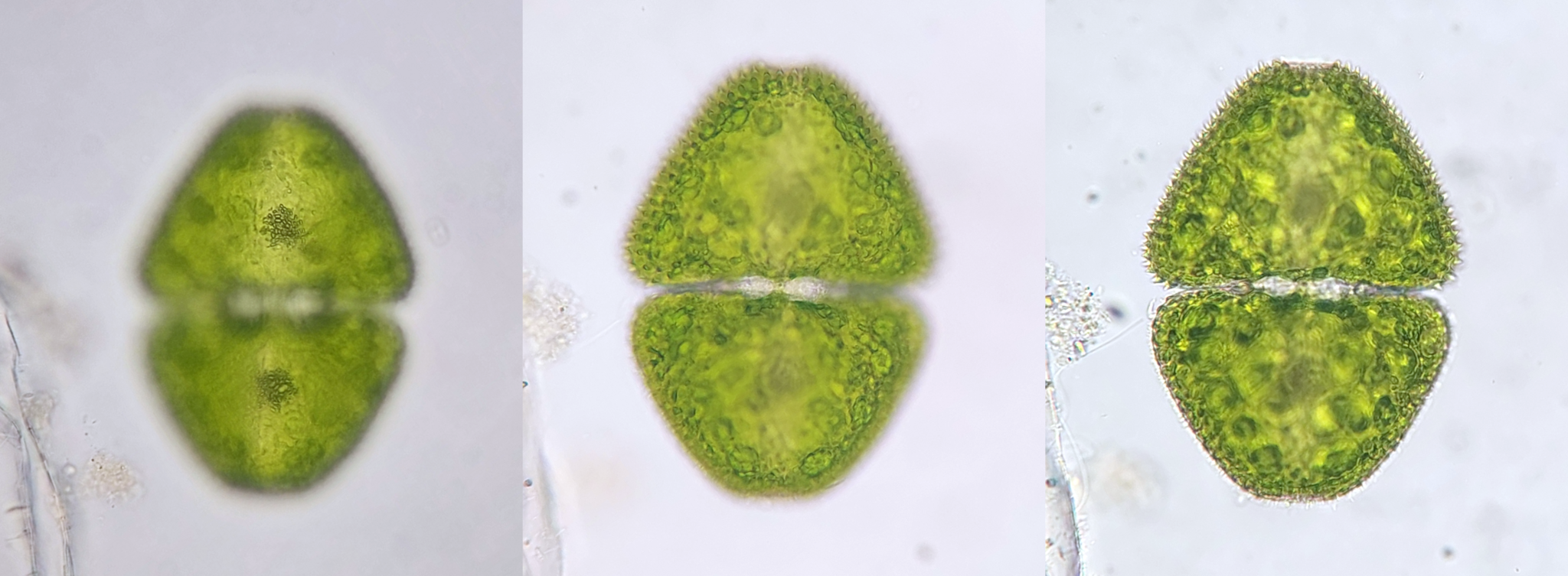 Cosmarium denticulatum