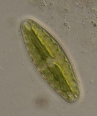 Netrium digitus