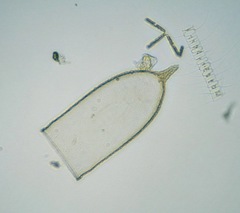 Favella