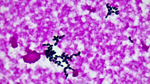 Candida parapsilosis