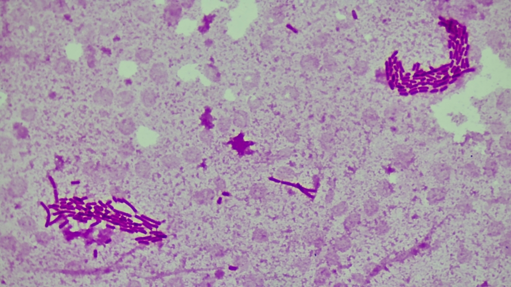 Klebsiella