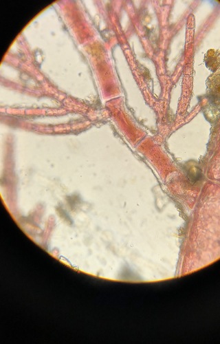 Image of Alternate Skein (Pleonosporium vancouverianum) by (c) Bridgette Clarkston, some rights reserved (CC BY-SA)