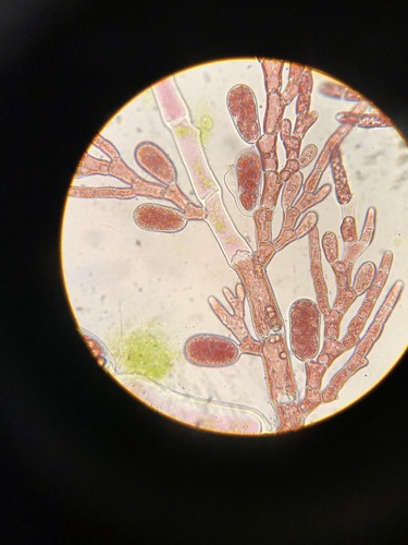 Image of Alternate Skein (Pleonosporium vancouverianum) by (c) Bridgette Clarkston, some rights reserved (CC BY-SA)
