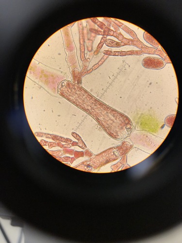 Image of Alternate Skein (Pleonosporium vancouverianum) by (c) Bridgette Clarkston, some rights reserved (CC BY-SA)